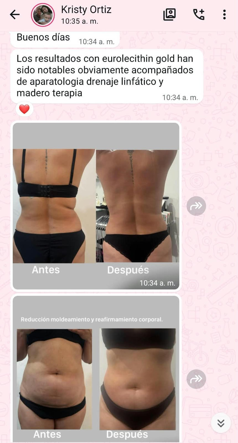 Testimonio de cliente EUROLECITHIN GOLD - 6 VIALES * 10 ML